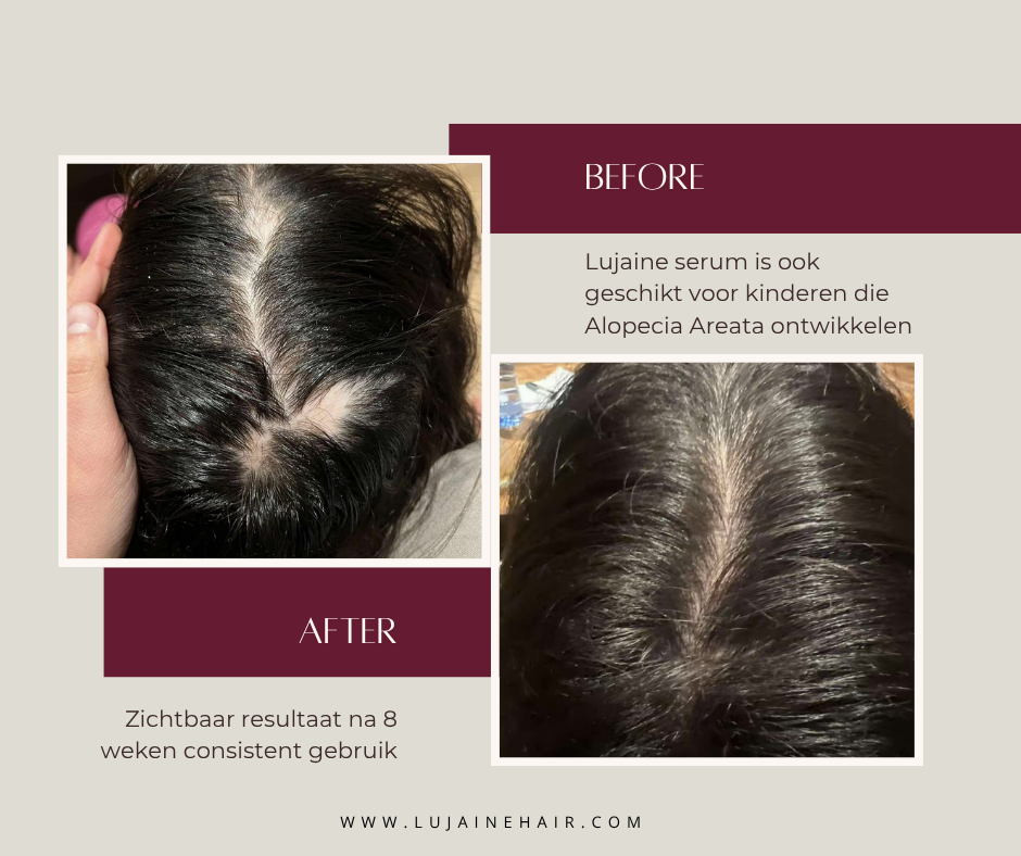 Lujaine Hair Food tegen haaruitval en het stimuleren van haargroei