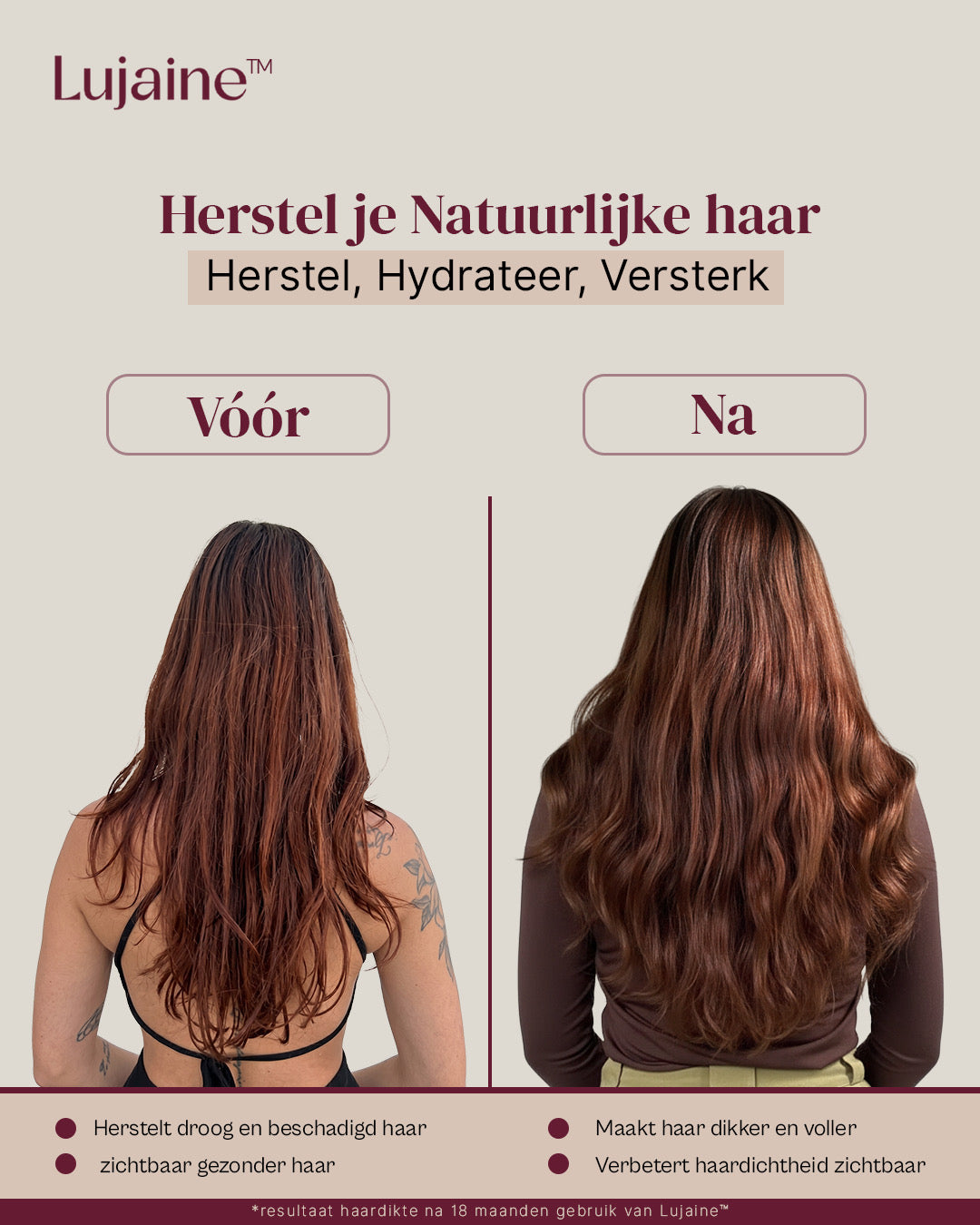 Lujaine Hairserum + Dermaroller - Sterker  &amp; Voller haar - Tegen haaruitval - Snellere haargroei