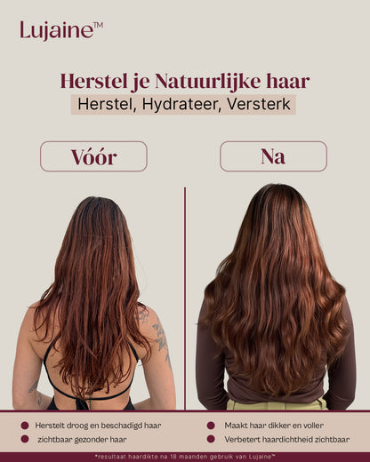 Lujaine Hairserum + Dermaroller - Sterker  &amp; Voller haar - Tegen haaruitval - Snellere haargroei