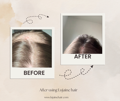 مصل نمو الشعر 50 مل