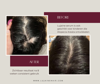 مصل نمو الشعر 50 مل