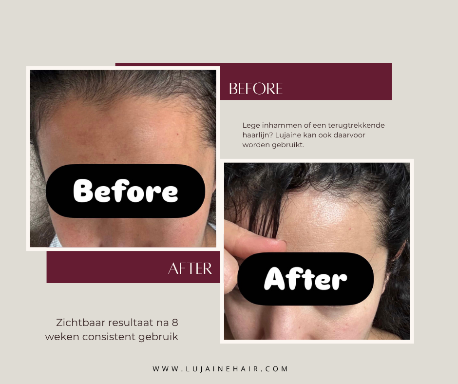 Lujaine Hair Food tegen haaruitval en het stimuleren van haargroei